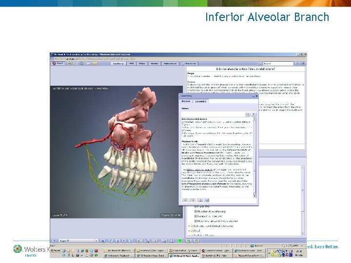 Inferior Alveolar Branch 