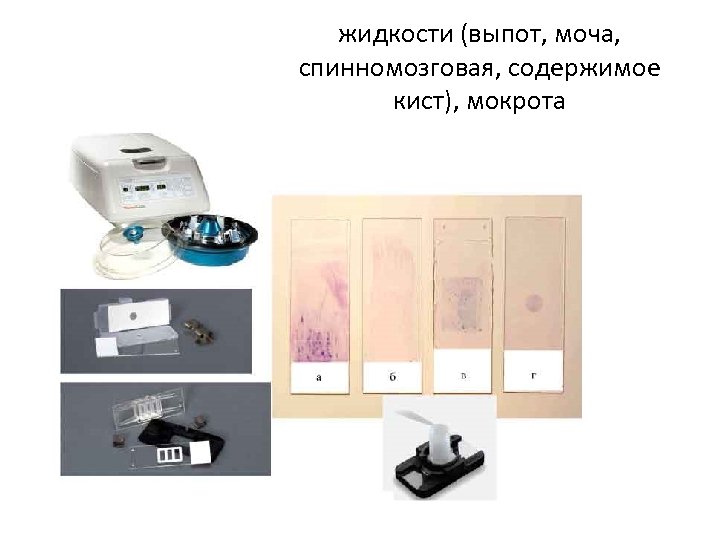 жидкости (выпот, моча, спинномозговая, содержимое кист), мокрота 