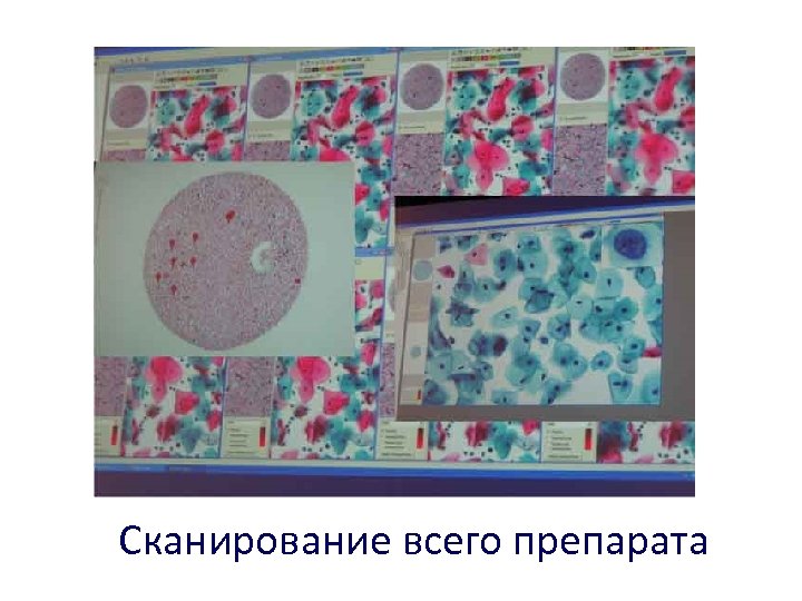 Сканирование всего препарата 