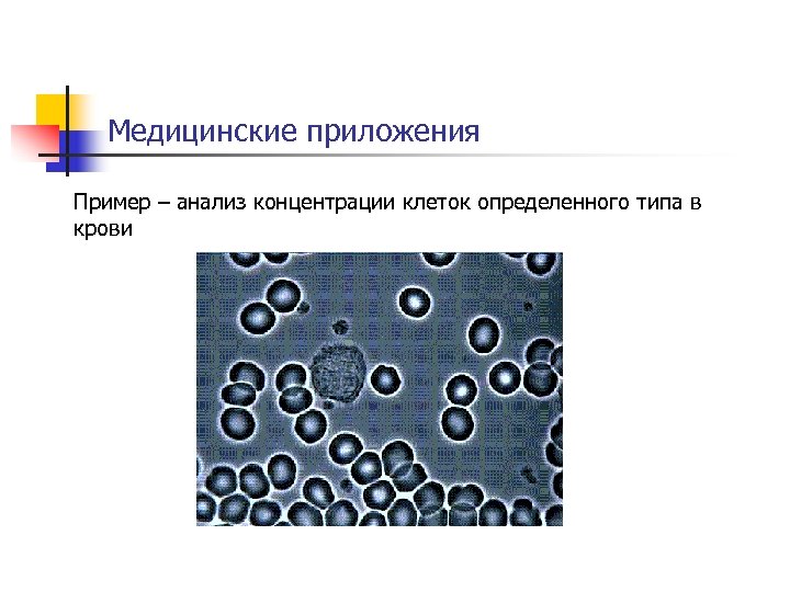 Медицинские приложения Пример – анализ концентрации клеток определенного типа в крови 