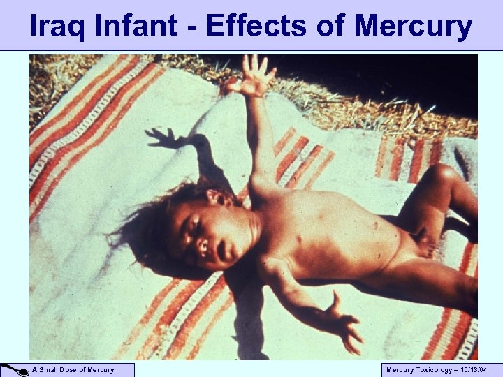 Iraq Infant - Effects of Mercury A Small Dose of Mercury Toxicology – 10/13/04