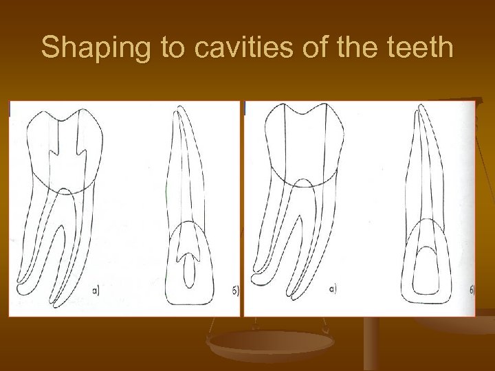 Shaping to cavities of the teeth 