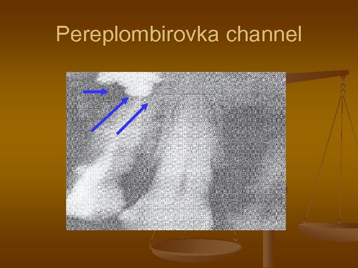 Pereplombirovka channel 