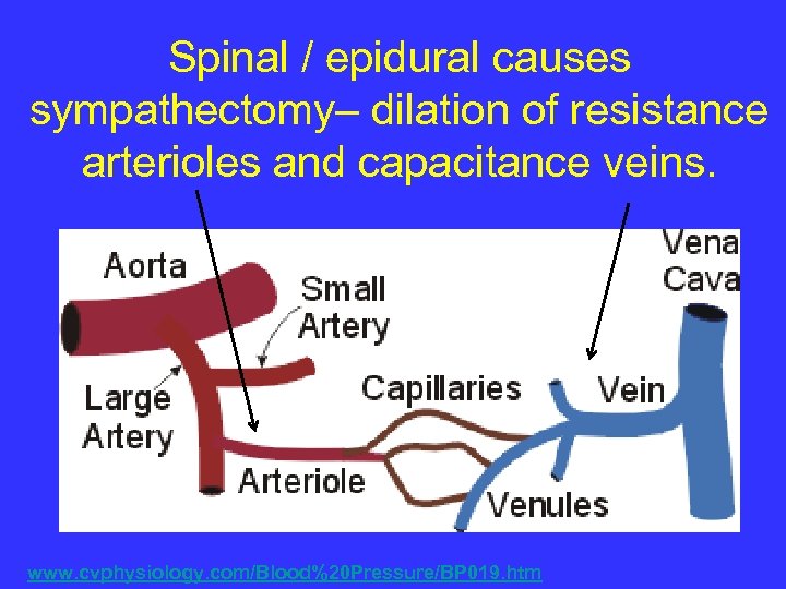 Spinal / epidural causes sympathectomy– dilation of resistance arterioles and capacitance veins. www. cvphysiology.