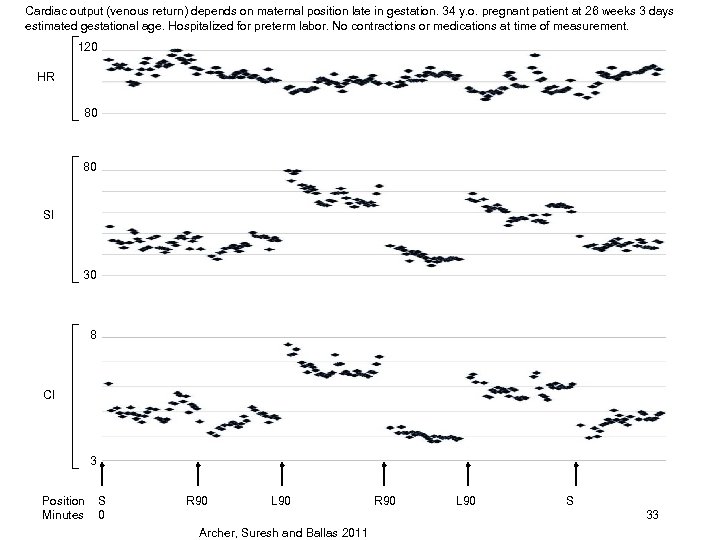 Cardiac output (venous return) depends on maternal position late in gestation. 34 y. o.
