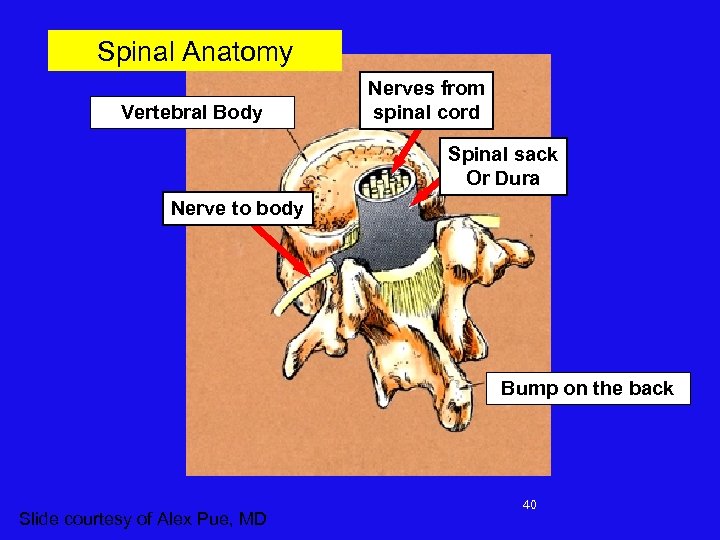 Spinal Anatomy Vertebral Body Nerves from spinal cord Spinal sack Or Dura Nerve to