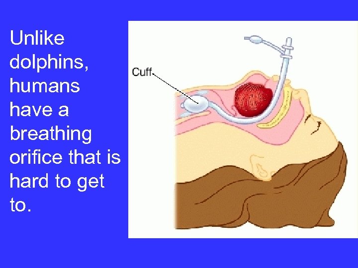 Unlike dolphins, humans have a breathing orifice that is hard to get to. 