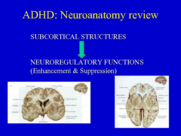 ADHD: Neuroanatomy review SUBCORTICAL STRUCTURES NEUROREGULATORY FUNCTIONS (Enhancement & Suppression) 