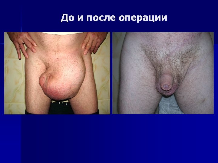 До и после операции 