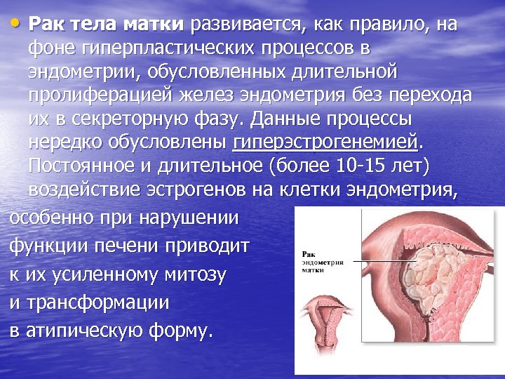 • Рак тела матки развивается, как правило, на фоне гиперпластических процессов в эндометрии,