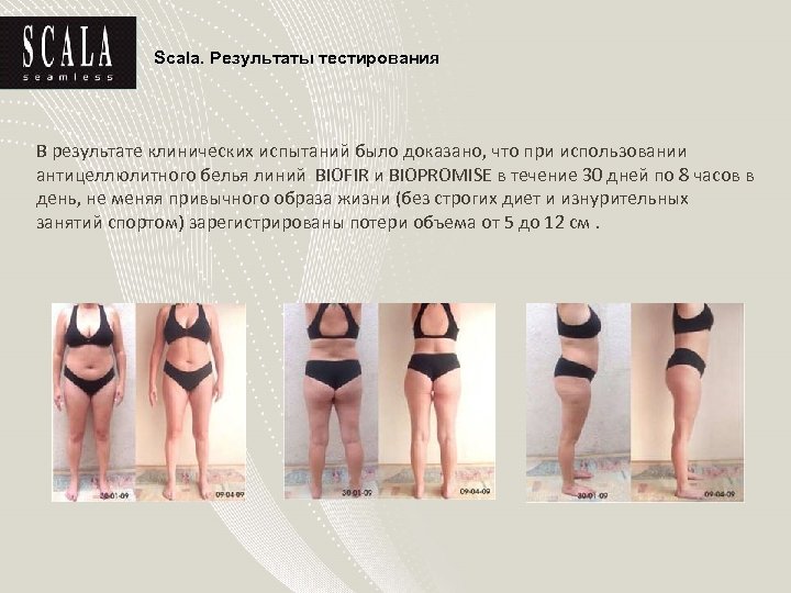 Scala. Результаты тестирования В результате клинических испытаний было доказано, что при использовании антицеллюлитного белья