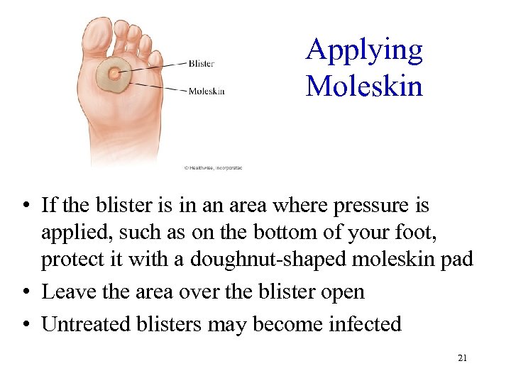 Applying Moleskin • If the blister is in an area where pressure is applied,