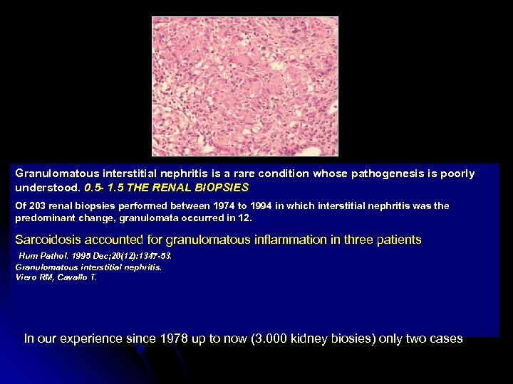 Granulomatous interstitial nephritis is a rare condition whose pathogenesis is poorly understood. 0. 5