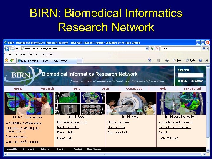 BIRN: Biomedical Informatics Research Network • dfsdfasdf National Institute of Biomedical Imaging & Bioengineering,