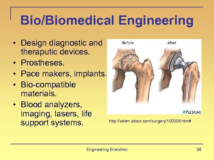 Bio/Biomedical Engineering • Design diagnostic and theraputic devices. • Prostheses. • Pace makers, implants.