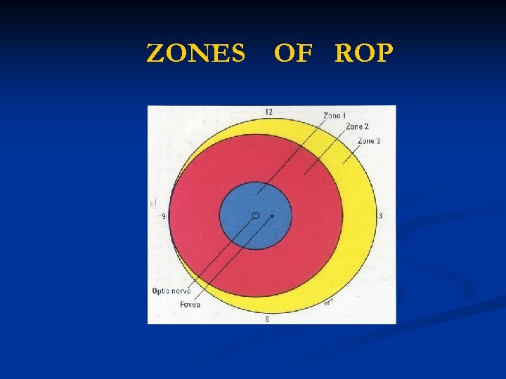 ZONES OF ROP 