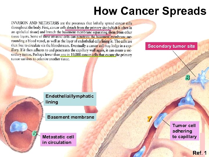 How Cancer Spreads Secondary tumor site Endothelial/lymphatic lining Basement membrane Metastatic cell in circulation