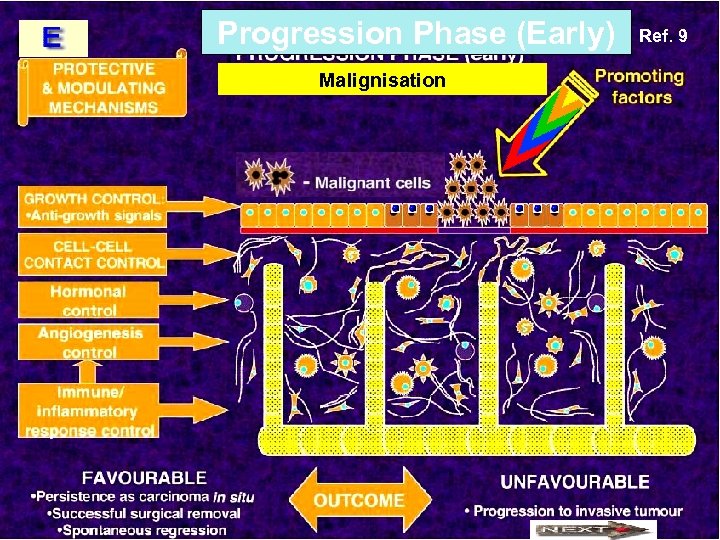Progression Phase (Early) Malignisation Ref. 9 