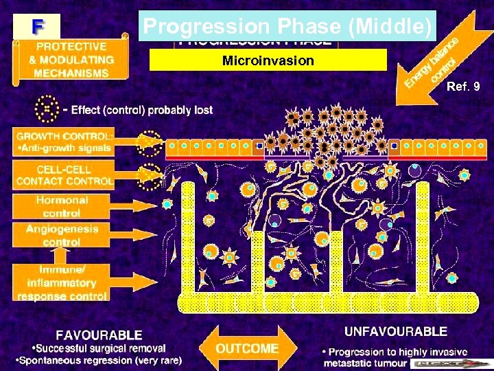 Progression Phase (Middle) Microinvasion Ref. 9 