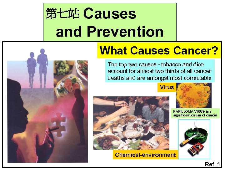 Causes and Prevention 第七站 What Causes Cancer? The top two causes - tobacco and