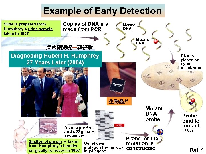 Example of Early Detection Slide is prepared from Humphrey’s urine sample taken in 1967