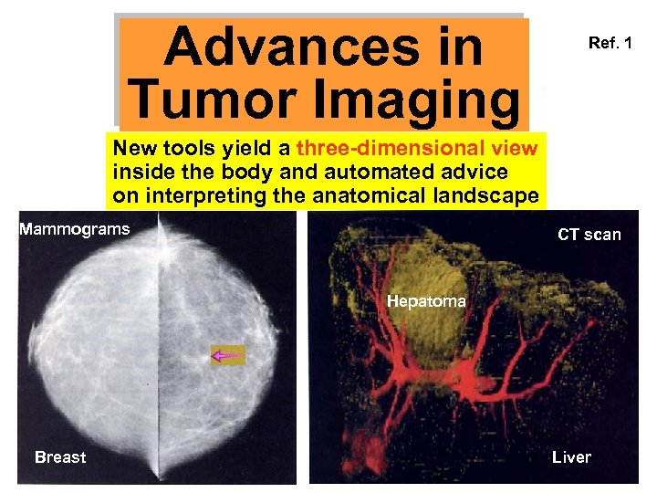 Advances in Tumor Imaging Ref. 1 New tools yield a three-dimensional view inside the