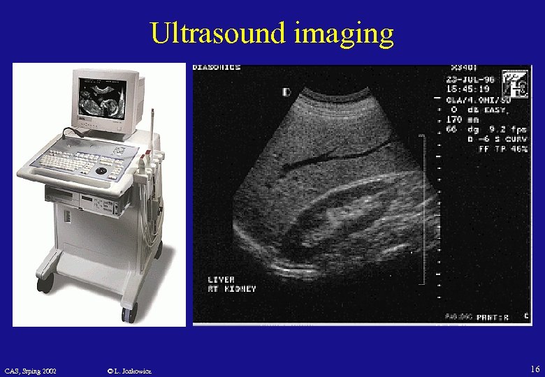 Ultrasound imaging CAS, Srping 2002 © L. Joskowicz 16 
