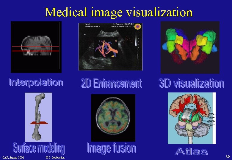 Medical image visualization CAS, Srping 2002 © L. Joskowicz 30 