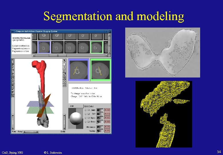 Segmentation and modeling CAS, Srping 2002 © L. Joskowicz 34 