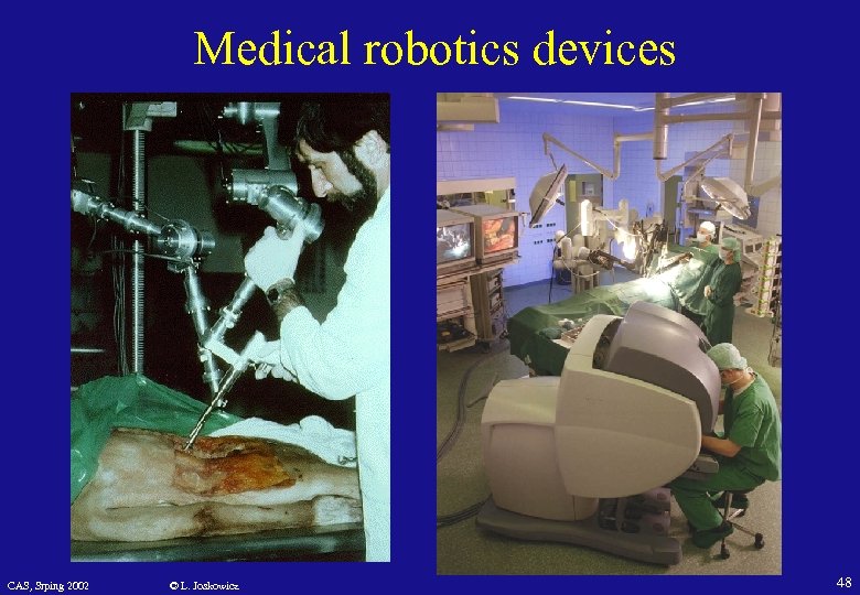 Medical robotics devices CAS, Srping 2002 © L. Joskowicz 48 