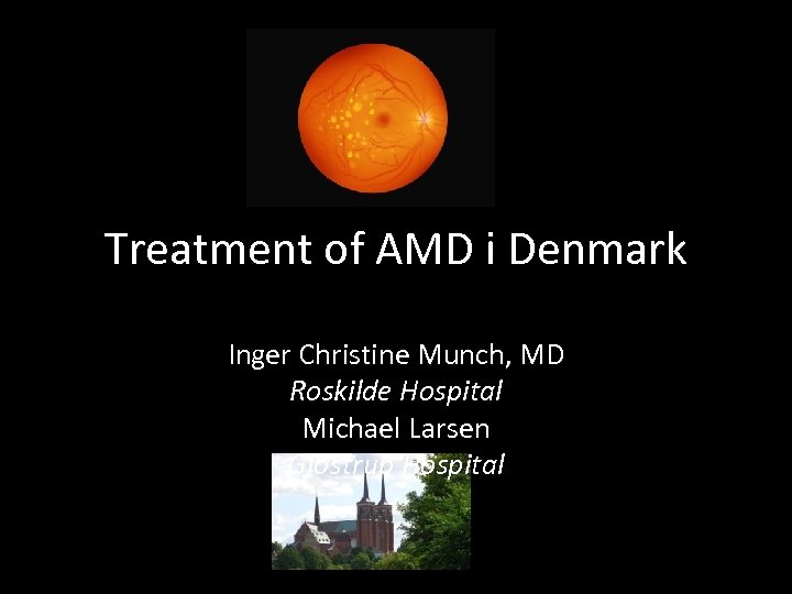 Treatment of AMD i Denmark Inger Christine Munch, MD Roskilde Hospital Michael Larsen Glostrup