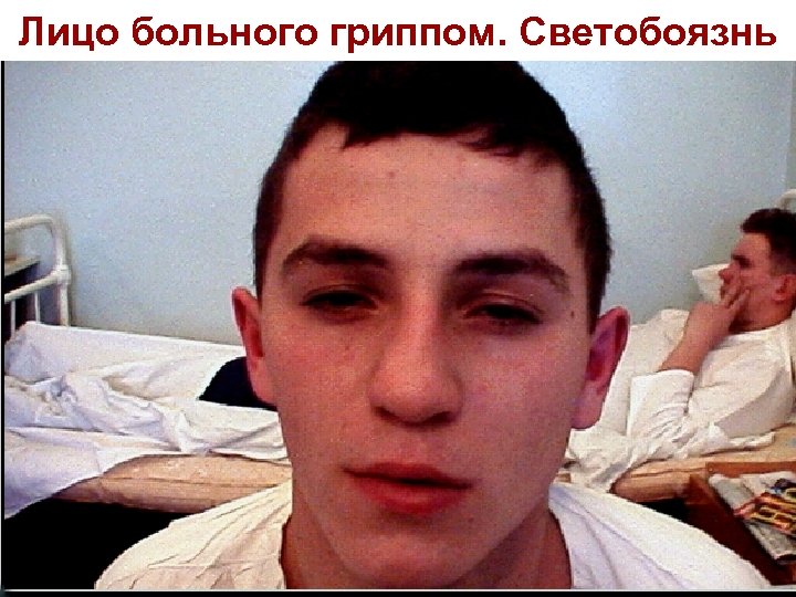 Лицо больного гриппом. Светобоязнь 