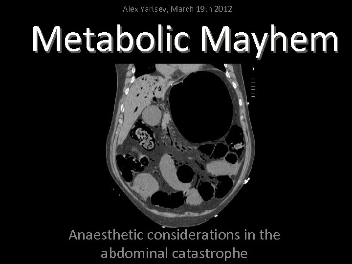 Alex Yartsev, March 19 th 2012 Metabolic Mayhem Anaesthetic considerations in the abdominal catastrophe