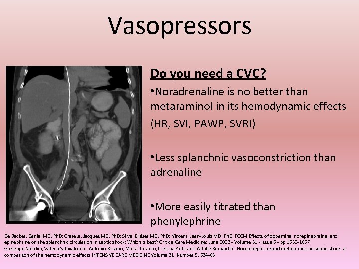 Vasopressors Do you need a CVC? • Noradrenaline is no better than metaraminol in