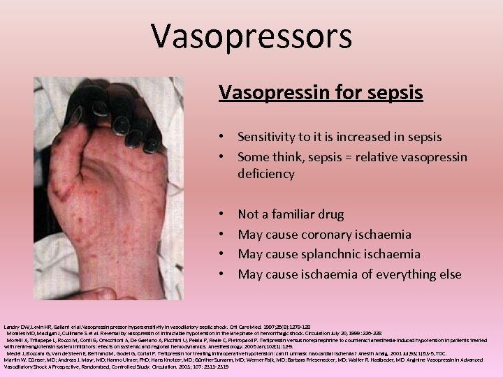 Vasopressors Vasopressin for sepsis • Sensitivity to it is increased in sepsis • Some