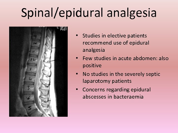 Spinal/epidural analgesia • Studies in elective patients recommend use of epidural analgesia • Few