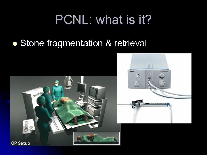PCNL: what is it? l Stone fragmentation & retrieval 
