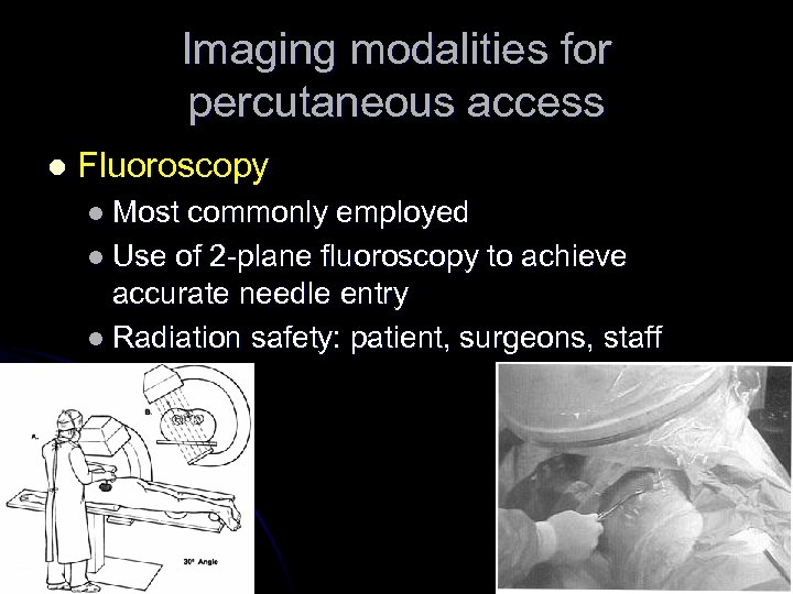 Imaging modalities for percutaneous access l Fluoroscopy l Most commonly employed l Use of