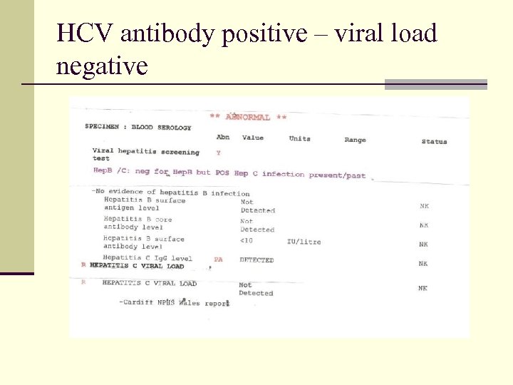 HCV antibody positive – viral load negative 
