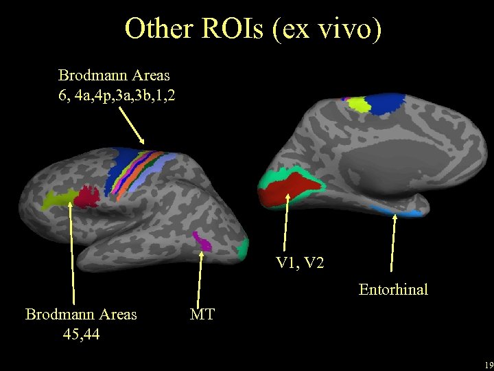 Other ROIs (ex vivo) Brodmann Areas 6, 4 a, 4 p, 3 a, 3