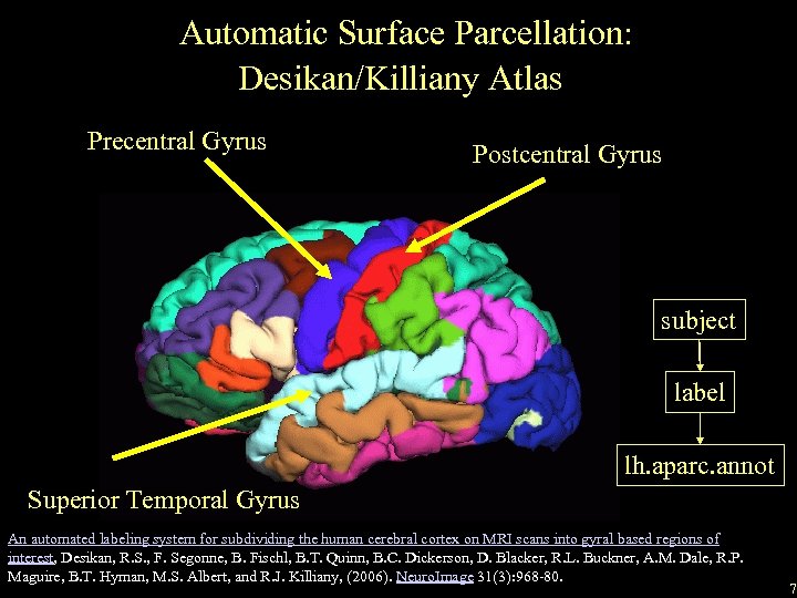 Automatic Surface Parcellation: Desikan/Killiany Atlas Precentral Gyrus Postcentral Gyrus subject label lh. aparc. annot