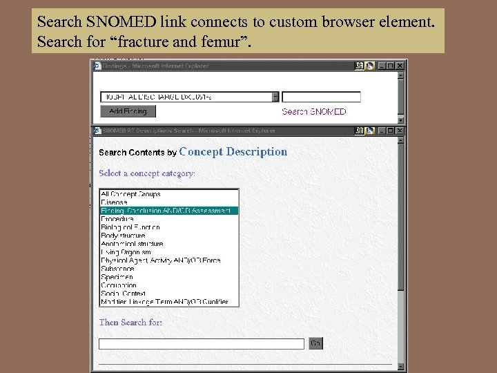 Search SNOMED link connects to custom browser element. Search for “fracture and femur”. 