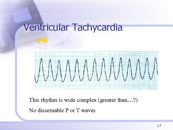 Ventricular Tachycardia VT This rhythm is wide complex (greater than…? ) No discernable P