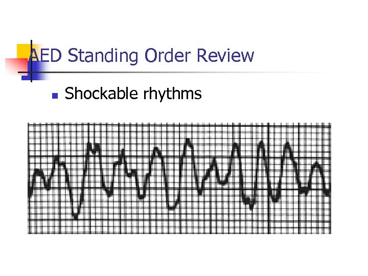 AED Standing Order Review n Shockable rhythms 