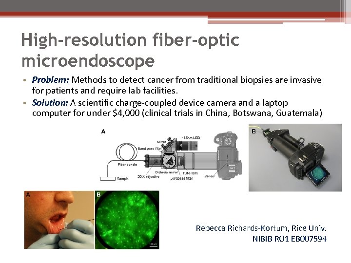 High-resolution fiber-optic microendoscope • Problem: Methods to detect cancer from traditional biopsies are invasive