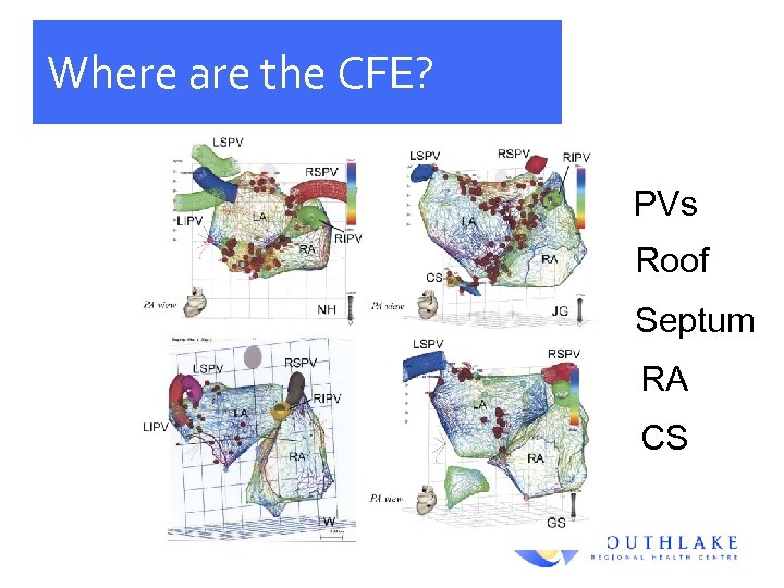 Where are the CFE? PVs Roof Septum RA CS 