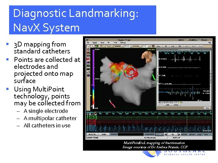 Diagnostic Landmarking: Nav. X System § 3 D mapping from standard catheters § Points