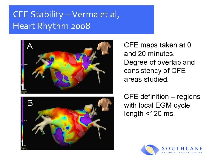 CFE Stability – Verma et al, Heart Rhythm 2008 CFE maps taken at 0