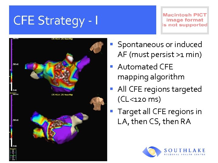 CFE Strategy - I § Spontaneous or induced AF (must persist >1 min) §