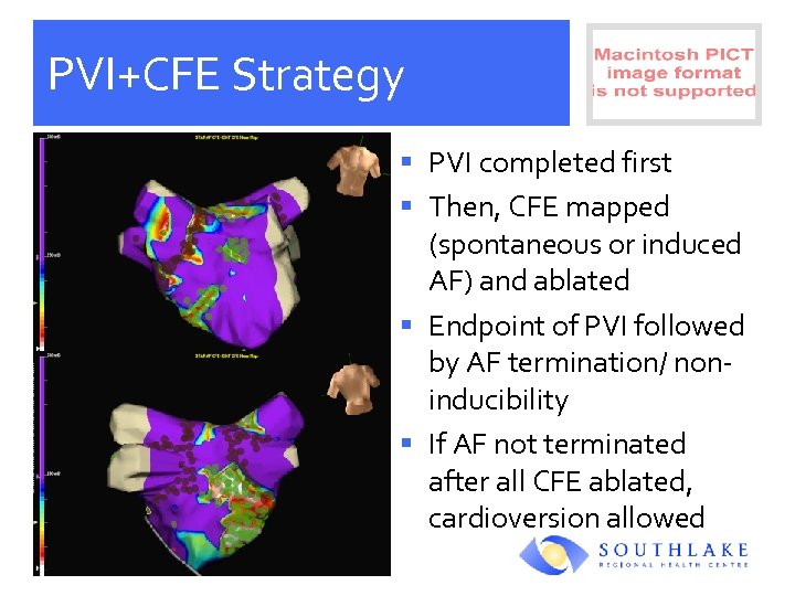 PVI+CFE Strategy § PVI completed first § Then, CFE mapped (spontaneous or induced AF)